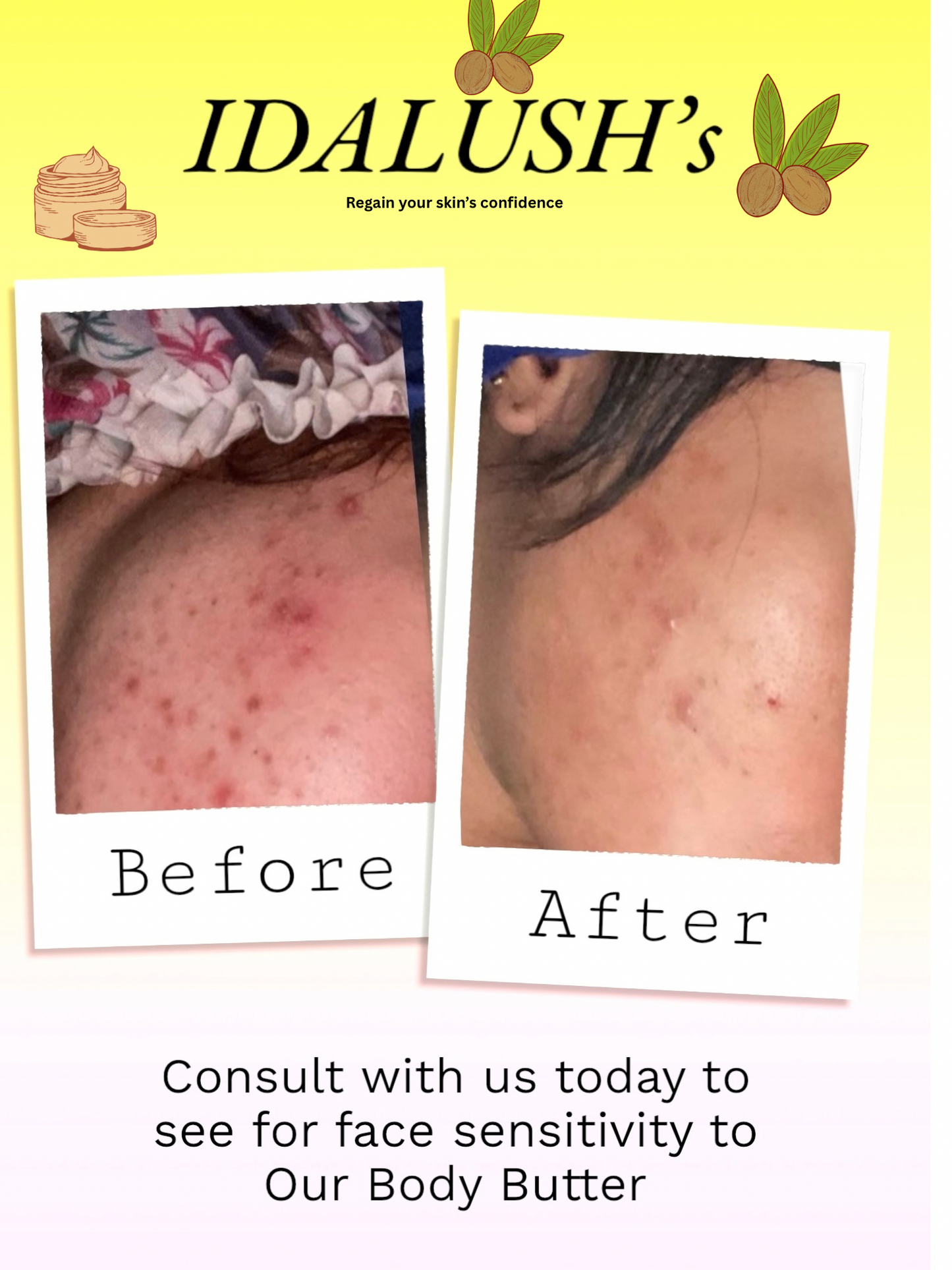 Tumeric Glow body butter - 8oz